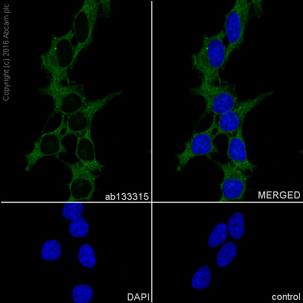 Anti-ARPC2 antibody [EPR8533] Rabbit monoclonal (ab133315) | Abcam