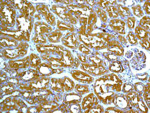 Immunohistochemistry (Formalin/PFA-fixed paraffin-embedded sections) - Anti-ARPC2 antibody [EPR8533] (AB133315)