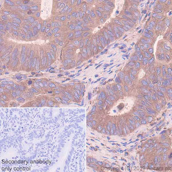 Immunohistochemistry (Formalin/PFA-fixed paraffin-embedded sections) - Anti-ARPC2 antibody [EPR8533] (AB133315)