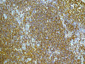 Immunohistochemistry (Formalin/PFA-fixed paraffin-embedded sections) - Anti-ARPC2 antibody [EPR8533] (AB133315)
