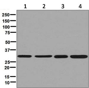 Western blot - Anti-ARPC2 antibody [EPR8533] (AB133315)