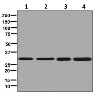 Western blot - Anti-ARPC2 antibody [EPR8533] (AB133315)
