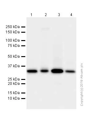 Western blot - Anti-ARPC2 antibody [EPR8533] (AB133315)