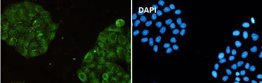 Immunocytochemistry/ Immunofluorescence - Anti-ARPC2 antibody [SR1558] (AB326690)