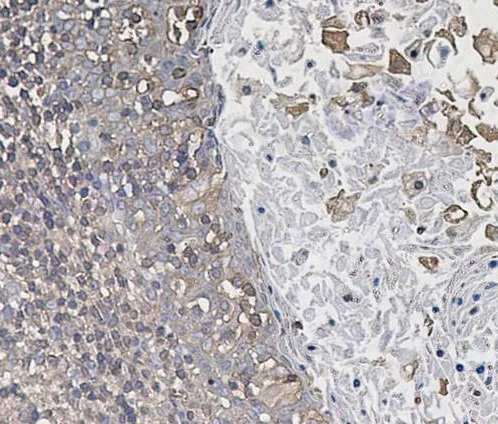 Immunohistochemistry (Formalin/PFA-fixed paraffin-embedded sections) - Anti-ARPC2 antibody [SR1558] (AB326690)