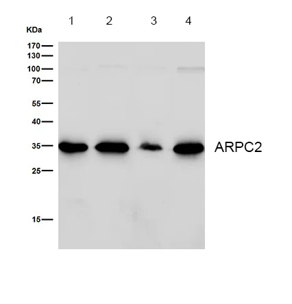 Western blot - Anti-ARPC2 antibody [SR1558] (AB326690)