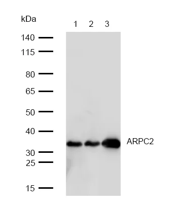 Western blot - Anti-ARPC2 antibody [SR1558] (AB326690)
