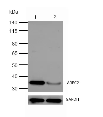 Western blot - Anti-ARPC2 antibody [SR1558] (AB326690)