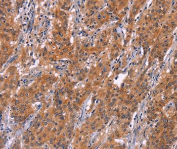 Immunohistochemistry (Formalin/PFA-fixed paraffin-embedded sections) - Anti-ARPC4 antibody (AB199114)