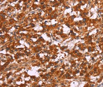 Immunohistochemistry (Formalin/PFA-fixed paraffin-embedded sections) - Anti-ARPC4 antibody (AB199114)