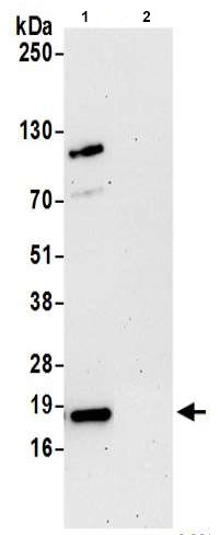 Immunoprecipitation - Anti-ARPC4 antibody (AB217065), expandable thumbnail
