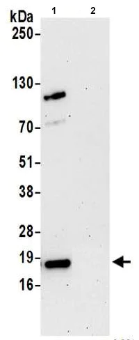 Immunoprecipitation - Anti-ARPC4 antibody (AB217065)
