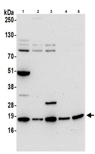 Western blot - Anti-ARPC4 antibody (AB217065), expandable thumbnail