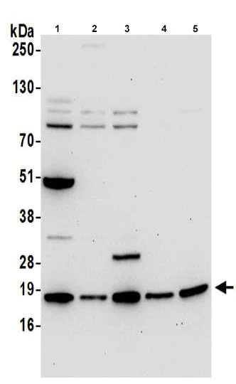 Western blot - Anti-ARPC4 antibody (AB217065)