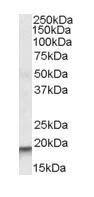 Western blot - Anti-ARPC4 antibody (AB80502)