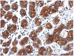 Immunohistochemistry (Formalin/PFA-fixed paraffin-embedded sections) - Anti-ARPC5/p16 ARC antibody (AB151303), expandable thumbnail