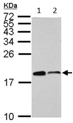 Western blot - Anti-ARPC5/p16 ARC antibody (AB151303), expandable thumbnail