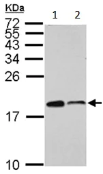 Western blot - Anti-ARPC5/p16 ARC antibody (AB151303)