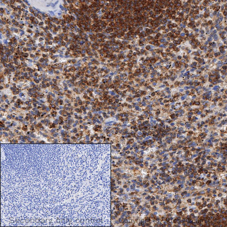 Immunohistochemistry (Formalin/PFA-fixed paraffin-embedded sections) - Anti-ARPC5/p16 ARC antibody [EP1551Y] (AB51243)