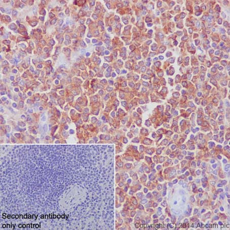 Immunohistochemistry (Formalin/PFA-fixed paraffin-embedded sections) - Anti-ARPC5/p16 ARC antibody [EP1551Y] (AB51243), expandable thumbnail