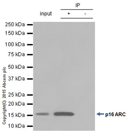 Immunoprecipitation - Anti-ARPC5/p16 ARC antibody [EP1551Y] (AB51243), expandable thumbnail