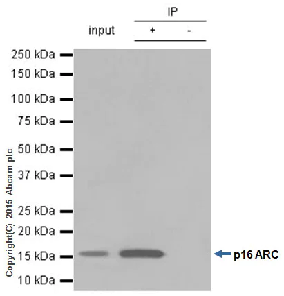Immunoprecipitation - Anti-ARPC5/p16 ARC antibody [EP1551Y] (AB51243)