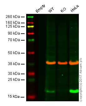 Western blot - Anti-ARPC5/p16 ARC antibody [EP1551Y] (AB51243)