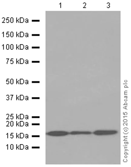 Western blot - Anti-ARPC5/p16 ARC antibody [EP1551Y] (AB51243)