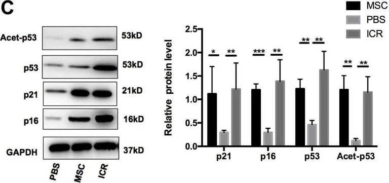 Western blot - Anti-ARPC5/p16 ARC antibody [EP1551Y] (AB51243)