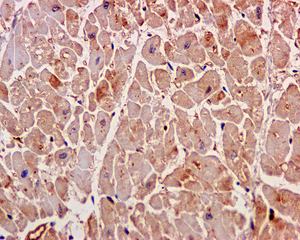 Immunohistochemistry (Formalin/PFA-fixed paraffin-embedded sections) - Anti-ARPC5L antibody [EPR10274] (AB169763), expandable thumbnail