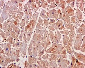 Immunohistochemistry (Formalin/PFA-fixed paraffin-embedded sections) - Anti-ARPC5L antibody [EPR10274] (AB169763)