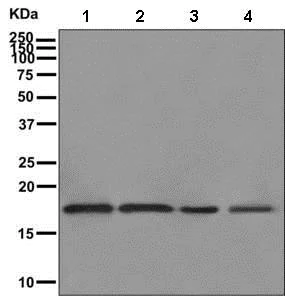 Western blot - Anti-ARPC5L antibody [EPR10274] (AB169763)