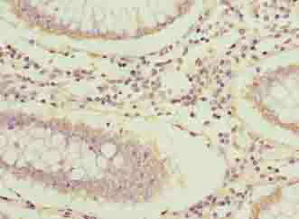 Immunohistochemistry (Formalin/PFA-fixed paraffin-embedded sections) - Anti-Arpin antibody (AB235421)