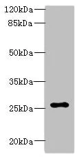 Western blot - Anti-Arpin antibody (AB235421)