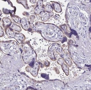 Immunohistochemistry (Formalin/PFA-fixed paraffin-embedded sections) - Anti-ARPP-19 antibody (AB188615), expandable thumbnail