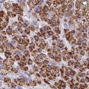 Immunohistochemistry (Formalin/PFA-fixed paraffin-embedded sections) - Anti-ARPP-19 antibody (AB188615), expandable thumbnail