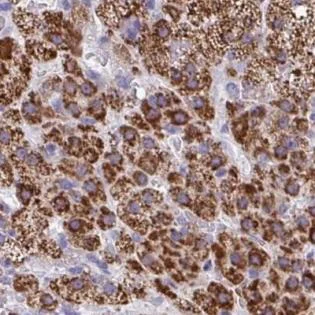 Immunohistochemistry (Formalin/PFA-fixed paraffin-embedded sections) - Anti-ARPP-19 antibody (AB188615)
