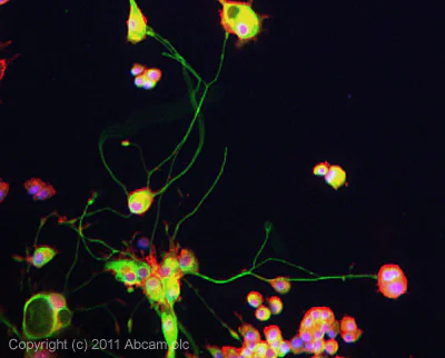 Immunocytochemistry/ Immunofluorescence - Anti-ARRDC3 antibody (AB64817)
