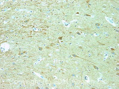 Immunohistochemistry (Formalin/PFA-fixed paraffin-embedded sections) - Anti-ARRDC3 antibody (AB64817)