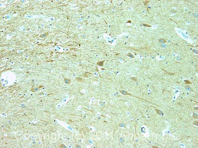 Immunohistochemistry (Formalin/PFA-fixed paraffin-embedded sections) - Anti-ARRDC3 antibody (AB64817)