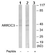 Western blot - Anti-ARRDC3 antibody (AB64817)