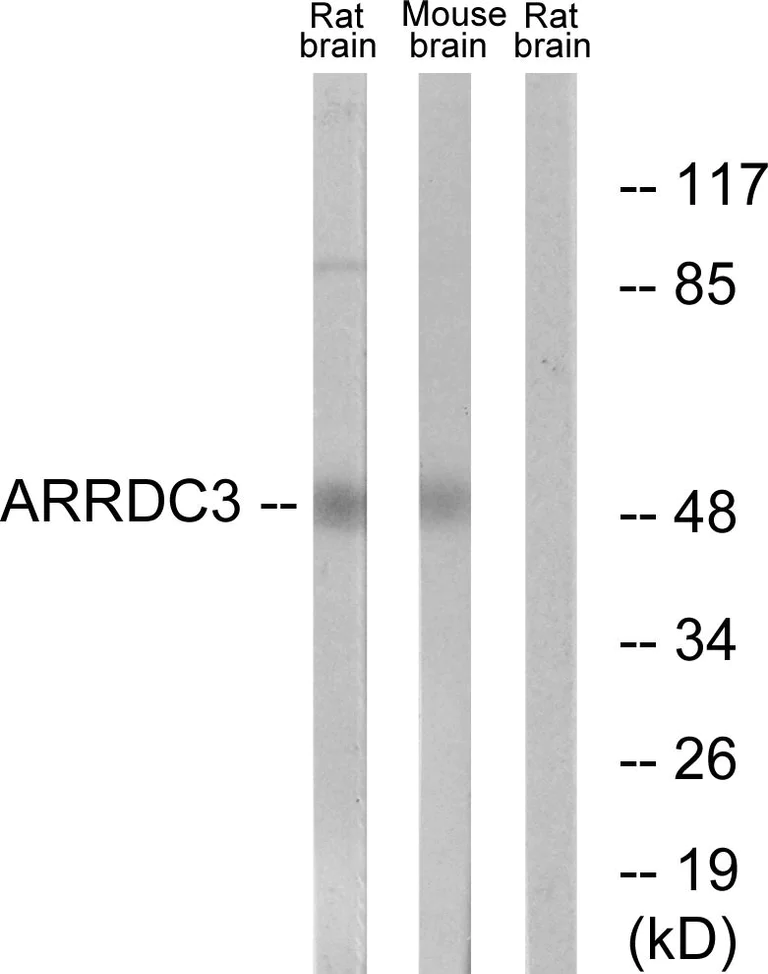 Western blot - Anti-ARRDC3 antibody (AB64817)