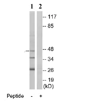 Western blot - Anti-ARRDC4 antibody (AB74265)