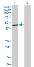 Western blot - Anti-Arrestin C antibody (AB167507)