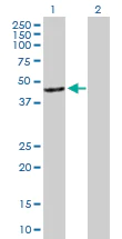 Western blot - Anti-Arrestin C antibody (AB167507)