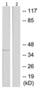Western blot - Anti-Arrestin C antibody - C-terminal (AB189437)