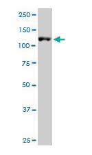 Western blot - Anti-ARS2 antibody (AB88392), expandable thumbnail