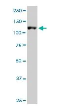 Western blot - Anti-ARS2 antibody (AB88392)