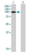 Western blot - Anti-ARS2 antibody (AB88392), expandable thumbnail