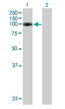 Western blot - Anti-ARS2 antibody (AB88392)
